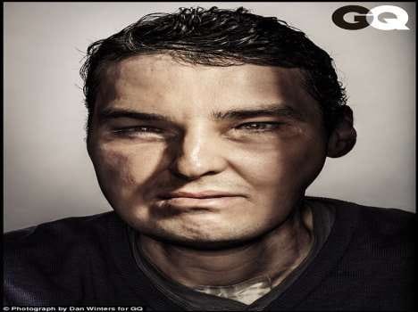 shotgun victim face becomes a magazine cover page model