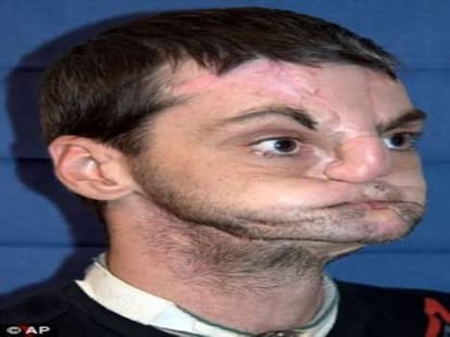 shotgun victim face becomes a magazine cover page model