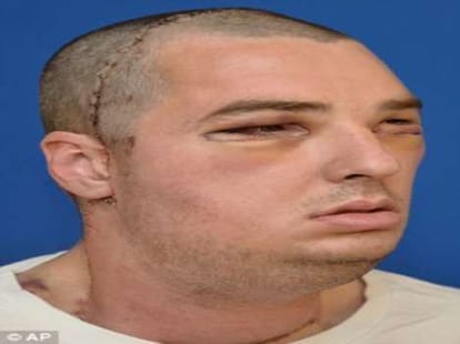 shotgun victim face becomes a magazine cover page model