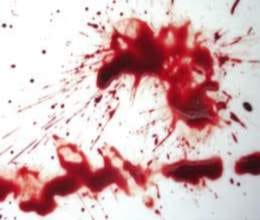 Jalandhar, sisters, brother, attack, head, property