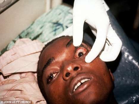 outbreak of ebola virus in west africa jp 