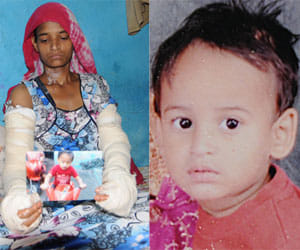 Kid falls in boiling oil after e-rikshaw hit