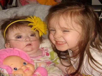 mom gives cannabis to dying daughter, lives jp