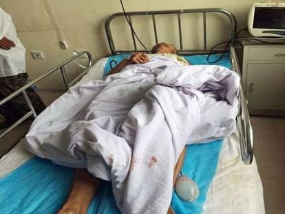 man cuts testicles of four people jp 