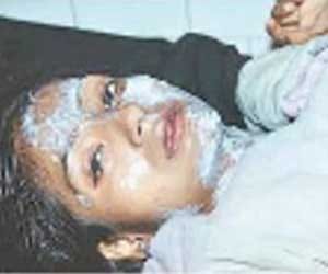 acid attack