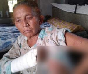son threw boiling tea on mother