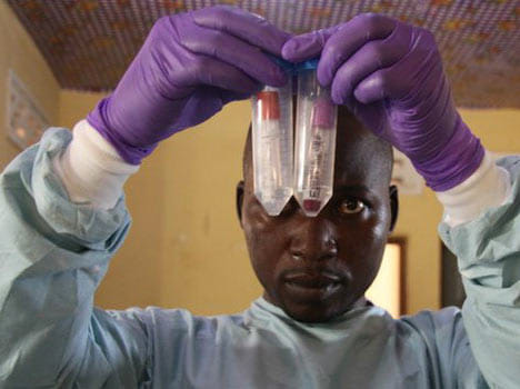 ebola virus