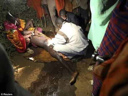 a dozen men underwent circumsicion to please wives jp