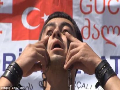 man lifts 33 kilo weight with eyelids