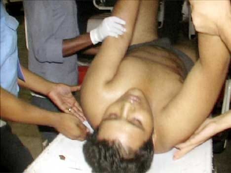 Rogues and police clash in greater noida, crook injured