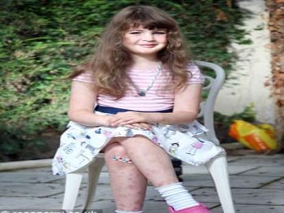 girl develops horrific rashes when she is sad