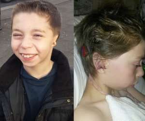 boy who got ears from his ribs