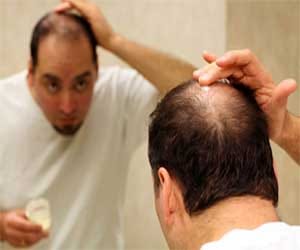 hair transplant in sgpgi lucknow