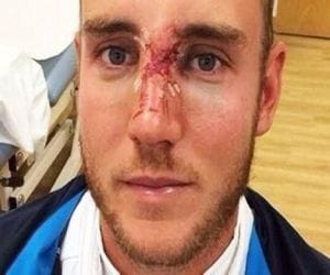 Stuart Broad will play 5th test with masked