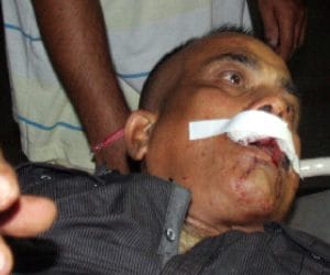 Attack on businessman who exposed booth scam