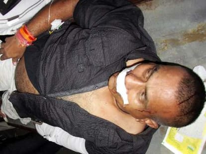 Attack on businessman who exposed booth scam