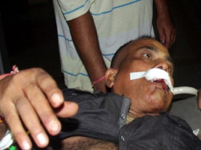 booth scam: after Attack on businessman security provide