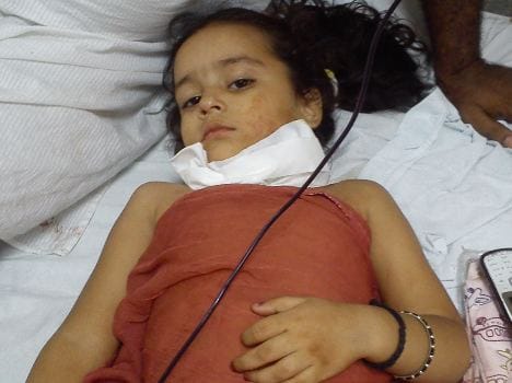 three year old injured due to kite string in jammu