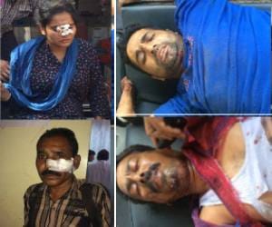 Collision of buses: woman killed, 24 injured