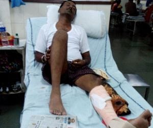 police staff beaten by biker at naka, Smashed leg