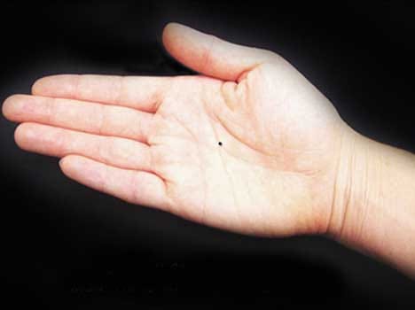 palmistry mars mole on palm