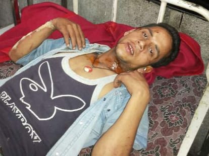 Breaking: Max in Rohru falls into ditch, died