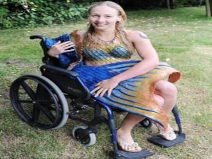 girl becomes mermaid to fight a medical problem
