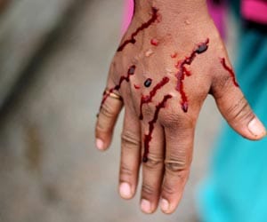 boy cut his vein infront girlfriend