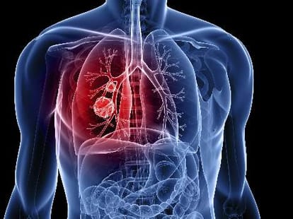 new facility is available for detect cancer gene.
