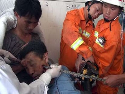 rod stuck inside man's face