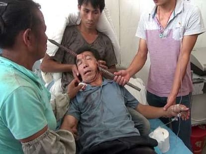 rod stuck inside man's face