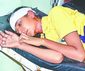 two injoured in road accedent