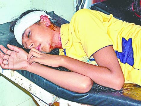 accident of school vehicle