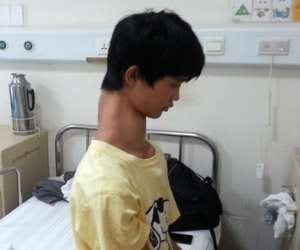 unusual long neck