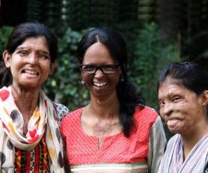 acid attack victim fashion show