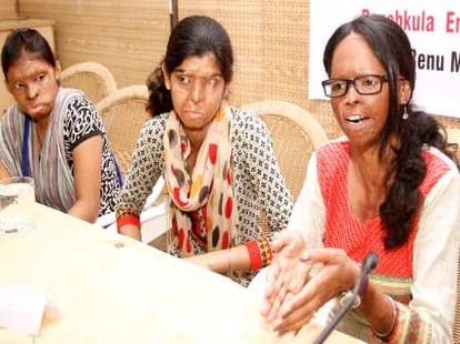 acid attack victims and her painful story