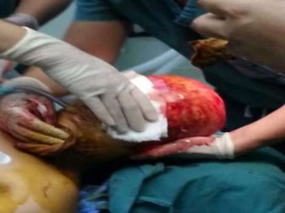 woman's head scalped abdly after an accident