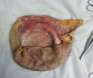 woman's head scalped abdly after an accident