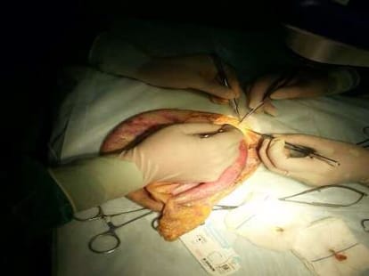 woman's head scalped abdly after an accident