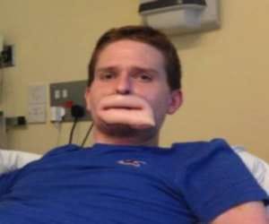 man with puffy lips