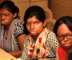 acid attack victims and her painful story