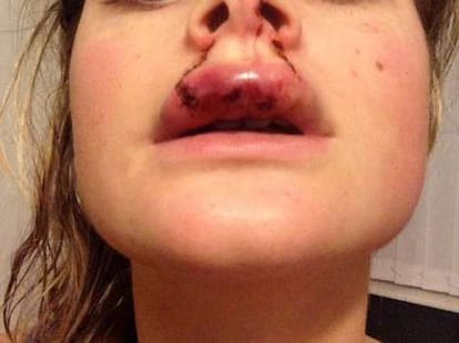 boyfriend bites girlfriend during a kiss