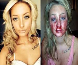 boyfriend bites girlfriend during a kiss