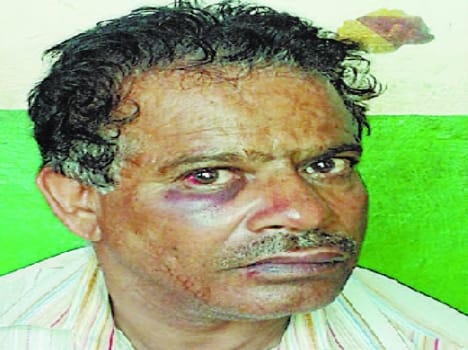 The attack on councilor's son in Baddi SDO
