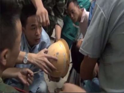 rod smeared into head 