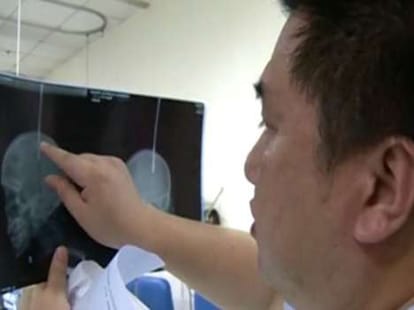 rod smeared into head 