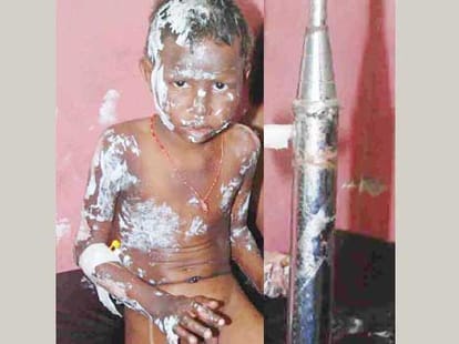 Cylinder blast in faridabad, 9 injured.