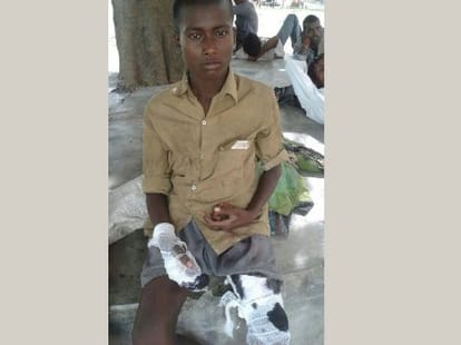 A boy had a fight with crocodile.