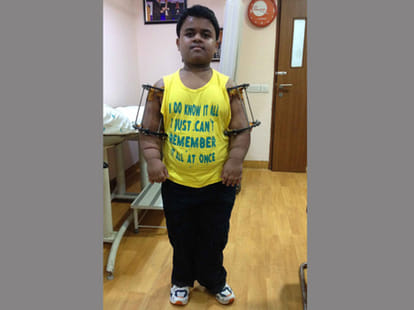 dwarf kid becomes 4 feet long after surgery.