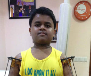 dwarf kid becomes 4 feet long after surgery.